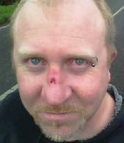 InjuredsabSurreyUnionFHmeet22-11-11.jpg