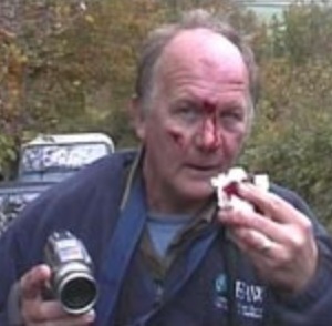 KevinHillafterattackbyChrisMarlesthenwithDSSH.jpg KevinHillafterattackbyChrisMarlesthenwithDSSH.jpg